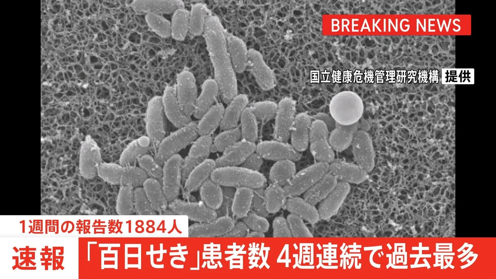 【速報】「百日せき」全国の1週間の報告数1884人　4週連続過去最多
