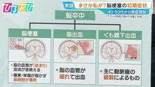 40代から増加「脳梗塞」の初期症状は？「倒れてからじゃ遅い」早期発見のカギ「BE FAST」とは【ひるおび】
