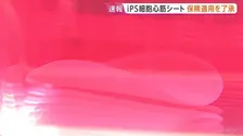 iPS細胞心筋シート「リハート」医療保険の適用を了承　心不全の治療用