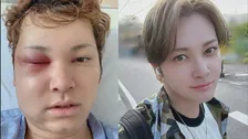 【 10万人に1人の難病・間瀬翔太 】　40歳迎えた想い綴る　「生きるってめちゃくちゃ難しいけど、本当に幸せ」「無事に41歳になれます様に」 【 脳動静脈奇形 】