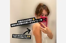 【 中川安奈 】 「季節外れの日焼け　地球の反対側の日差しおそるべし！笑」「本当に日焼けしやすい体質で笑笑」