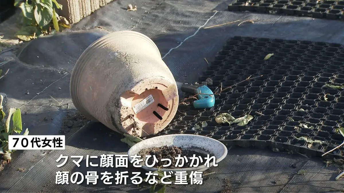 70代の女性がクマに顔面ひっかかれる　顔の骨を折るなど重傷　富山・立山町