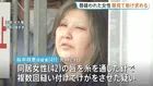 唇を縫われた女性、容疑者が外出した隙に近くの商店に助け求める　49歳女が針と糸で同居女性の唇縫い付けたとして逮捕の事件　茨城・古河市