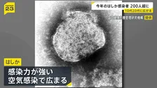 「はしか」感染広がる　10代…32%、20代…25%　今年の感染者236人（今月5日時点）