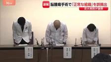 【速報】京大病院で医療事故 脳腫瘍の手術で「正常な組織」を誤って摘出 50代女性患者は自発呼吸できず