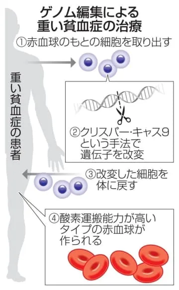 ゲノム編集技術の治療、初実用化