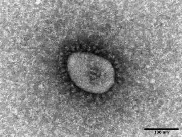 国内コロナ死者、最多の498人